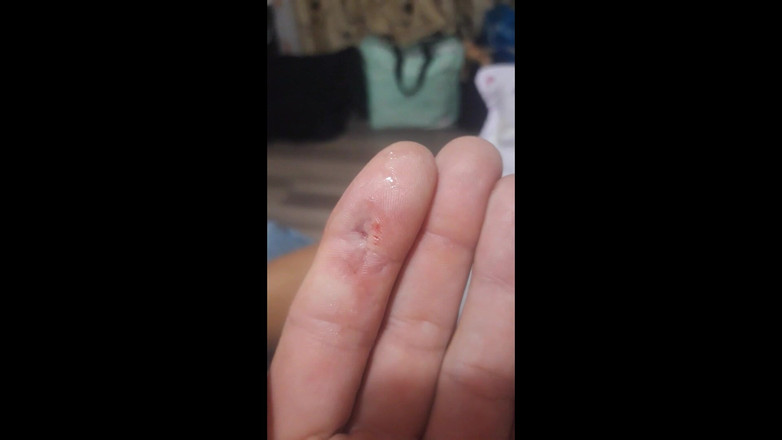 Paultramp: Fingerbiss