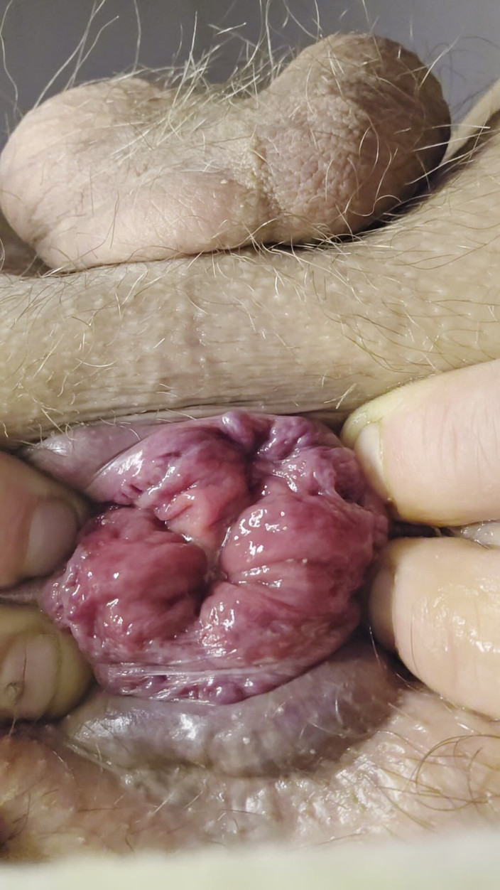 Nalekhome: 내 작은 장미와 핑거링 후장