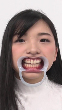 Osservazione dei denti denti naturali ma cavità potenziali trovate!! La bella ammicca quando i suoi denti vengono toccati - suzu shiratori