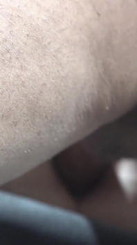 Day 30 of 30 Straight Days of Anal - Bonnie's Asshole Destroyed While She's Strapped in Gyno Chair