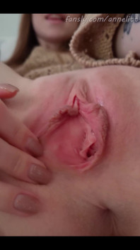 This Hole Needs Your Attention!
