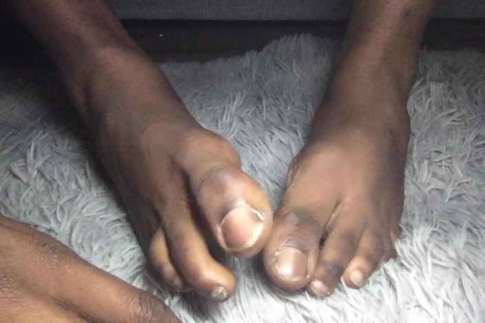 Teddy south: Big Black Feet