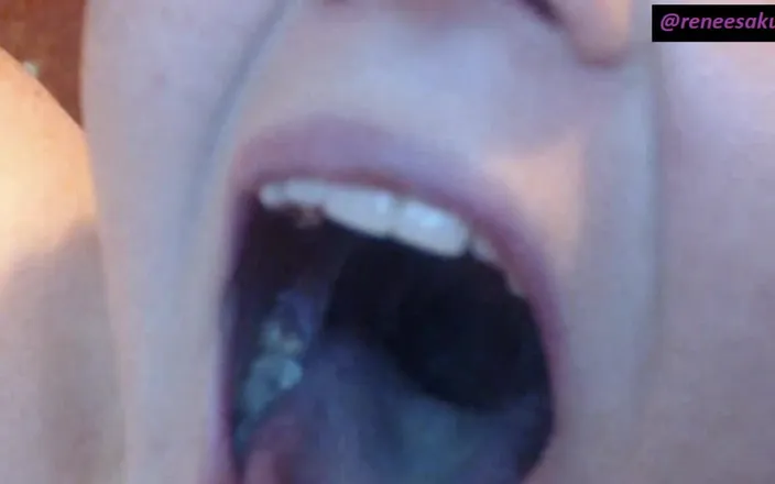 Renee Sakuya: Inside My Mouth Sore Throat