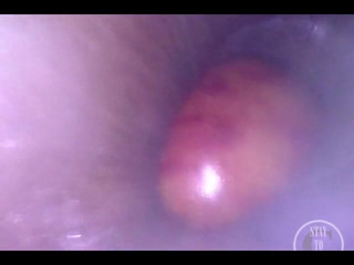 Lina Free: POV Jablko vstupuje do zadku