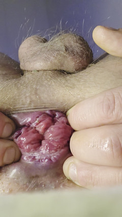 Nalekhome: La mia piccola rosa ed il ditalino del mio culo