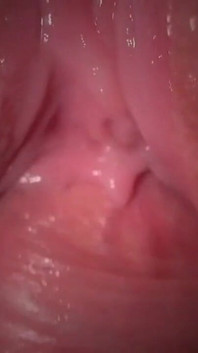 Userdate: Kepada pengeras krim