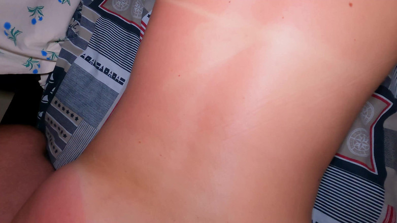 Love_Adventures: Adik tiri saya dibakar matahari dan meminta bantuan!