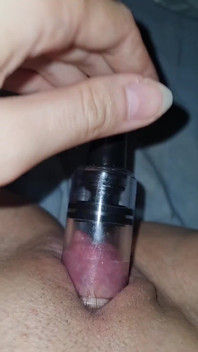 Pepek bengkak dengan puting...