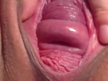 AAAAA