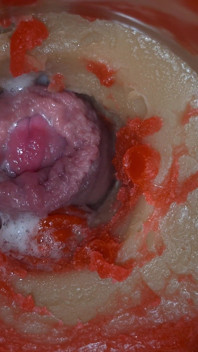 Inseminasi - Kamera Internal Merekam Ejakulasi Pria Dalam