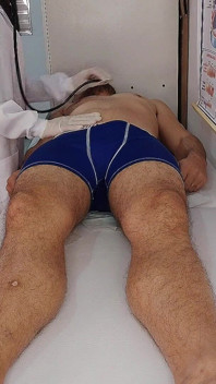 看護師が患者の勃起を観察する