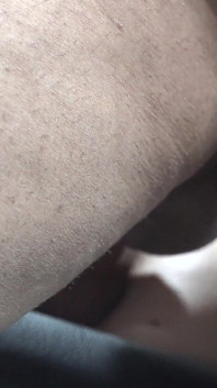 30 heteroseksüel anal günün 30. günü - Bonnie jinekoz sandalyesinde bağlıyken göt deliği parçalandı