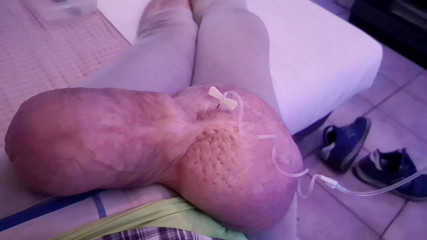 Monster_Meat_: Filling up with 1liter glucose