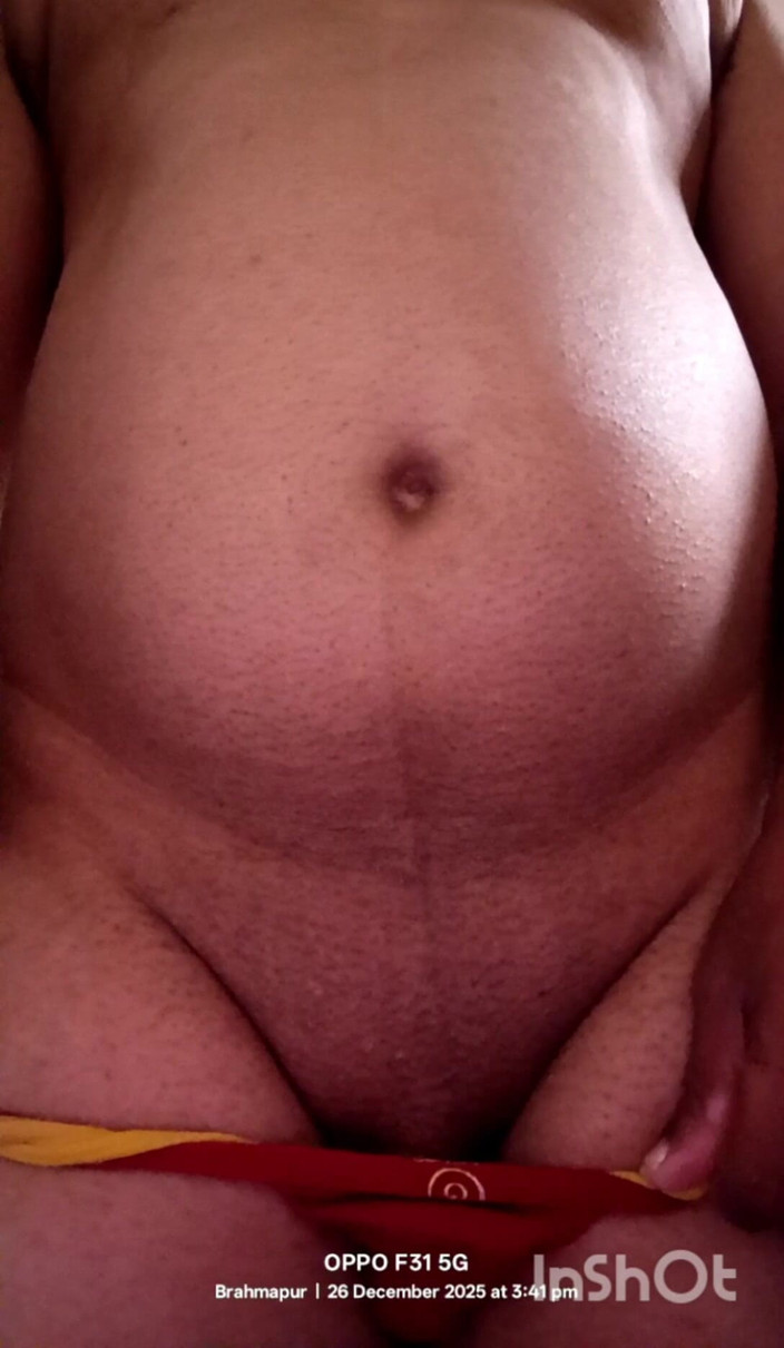 Rebatipatra: Nett, mein arsch