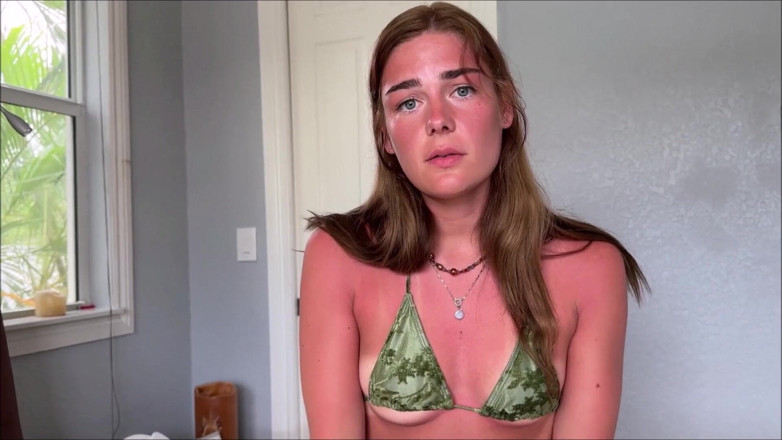 Alex Adams: Küçük üvey kız kardeşin güneş yanığı kazası - arabella rose - aile terapisi