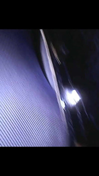 Speculum & Microcamera for Lady Soniac