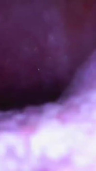 Deep Inside Sydney's Mouth - Sydney Screams Shows off Mouth, Tongue, Throat, and Uvula with Endoscope