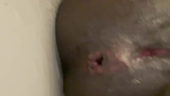 Ebony Amputee: Pemeriksaan Anal Diri
