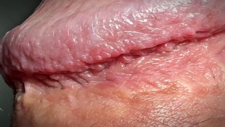 Leonardo-1974: Orinar en los testículos