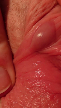 I Pull the Hood off My Clit and Show It to You up Close