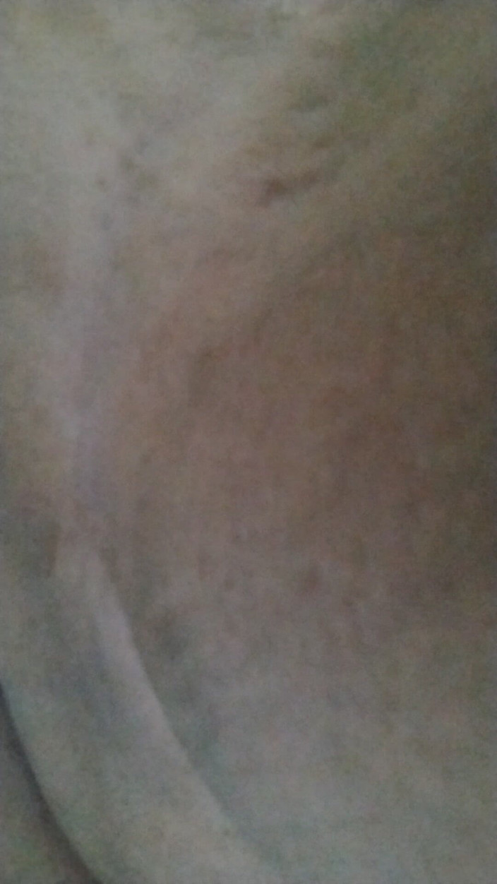 JG Risk: 3-8-2026 pertunjukan taint