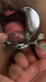 Exl-013: Huge Stretched Loose Pussy Hole Cervix View Speculum in Ass Maria Caldas - Full Scene Extremelatina Exl-013