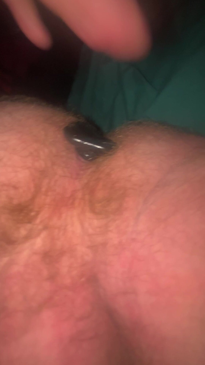 Bigwhitecock: Je m’étire le cul avec un plug anal