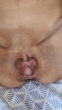 18-year-old Skinny Teen Takes Extreme Fisting, Her Whole Hand in Her Pussy