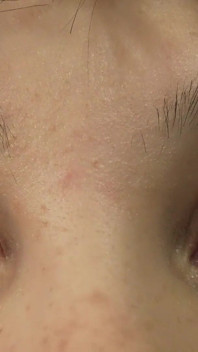 Vieni miei occhi perché ho un feticcio degli occhi e ti mostrerò i miei occhi da vicino