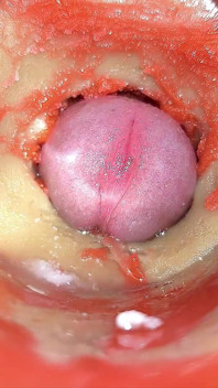 Kamera dalam sudut pandangan pertama Cervix dubur, dicuckold kecil oleh 'pasangan gergasi', pancutan mani dalam dubur dan creampie - Asmr