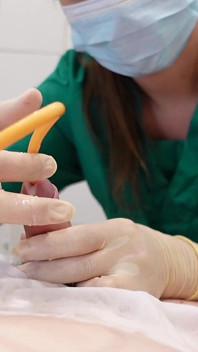 Medfet katheterspiel, handjob und auferlegter orgasmus mit vibrator