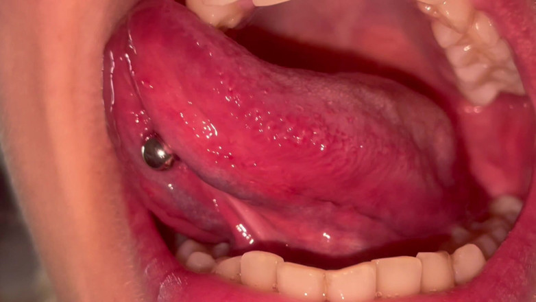 Glitterqueen1999: Tour de boca sin maquillaje, cuenta de dientes, úvula chequear de...