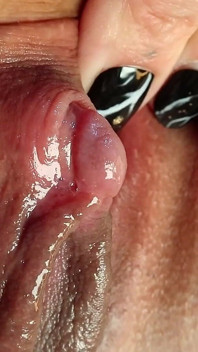 Clitoris HD 2