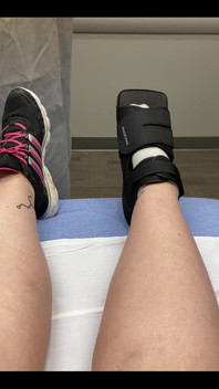 Welp, I messed up my foot