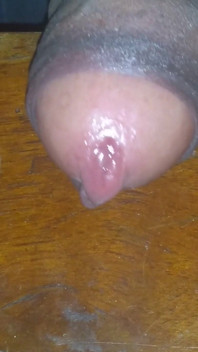 Ereksi langsung