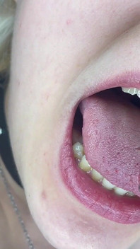 Mouth Tour
