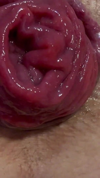 Anal aberto close-up prolapso e pés show em meia-calça branca