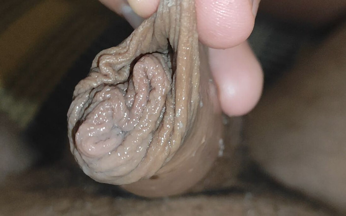 Straight Daddy Club: Détacher Lentement Le Prépuce Du Gland.