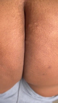 BBC Backshots: Ft Mr Blvck Rose