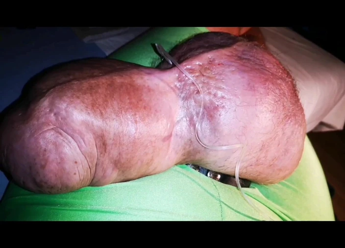 Monster_Meat_: Telur besar melantun dari kiri ke kanan