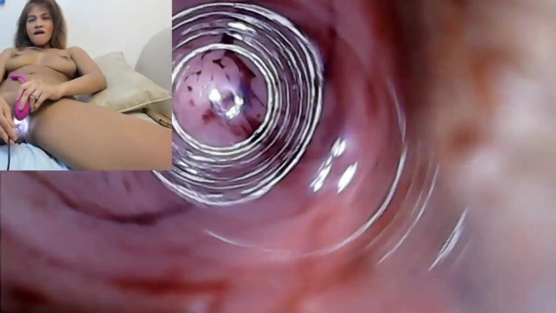 SexyGamingCouple: Endoskop cipki kamera Materiał z creampie na Jej Monthly with...
