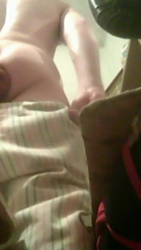 A Young Guy Is Sitting on a Chair with Anal Prolapse
