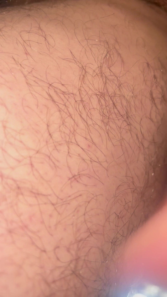 Pelakas: A primeira vez da minha esposa tentando fazer anal