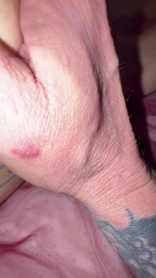 Canccr: Maak het klaar