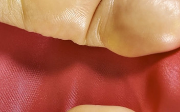 Pink Foxx: Melancap di tapak tangan yang mendominasi skrin