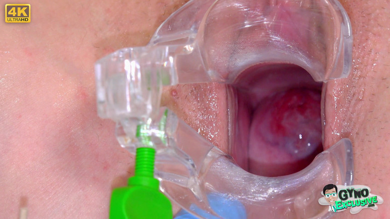 Gyno Exclusive: La bomba sessuale in silicone riceve un trattamento per la...