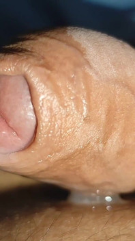 Stepdaddy Opens His Phimosis and Gets a Big Load.