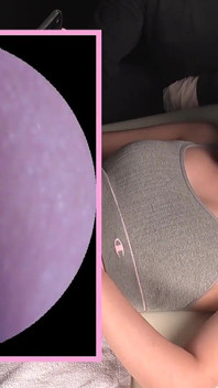 Rei Aino Explores, Smells, Cleans - Belly Button Under Microscope part 2