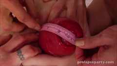 Prolapse party: Medida de prolapso