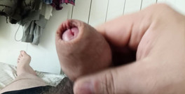Big Pisser: Smegma péro oteklá předkožka